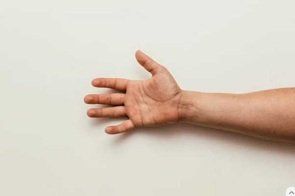 এলিয়েন হ্যান্ড সিনড্রোম কী, লক্ষণ ও চিকিৎসা জেনে রাখুন