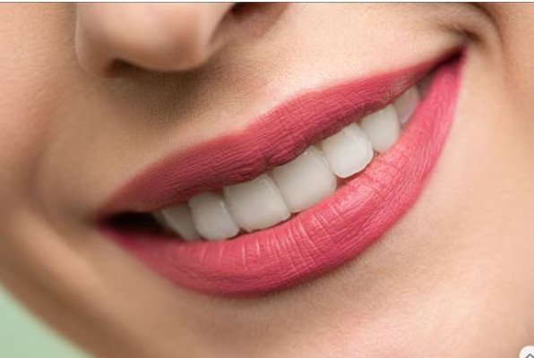 দাঁত প্রতিস্থাপনের আগে যেসব বিষয় জেনে রাখবেন