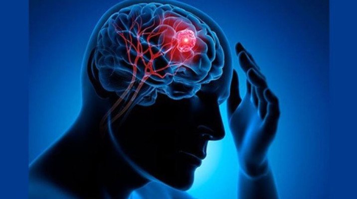 মস্তিষ্কের টিউমারের যে ৭টি লক্ষণ ভুলেও এড়িয়ে যাবেন না