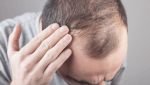 পুরুষদের চুল পড়া বন্ধে কার্যকর ফিনাস্টারাইড, যা বলছে গবেষণা