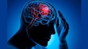 মস্তিষ্কের টিউমারের যে ৭টি লক্ষণ ভুলেও এড়িয়ে যাবেন না